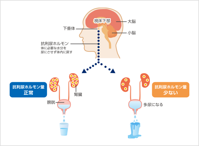 トイレ 近い なぜ