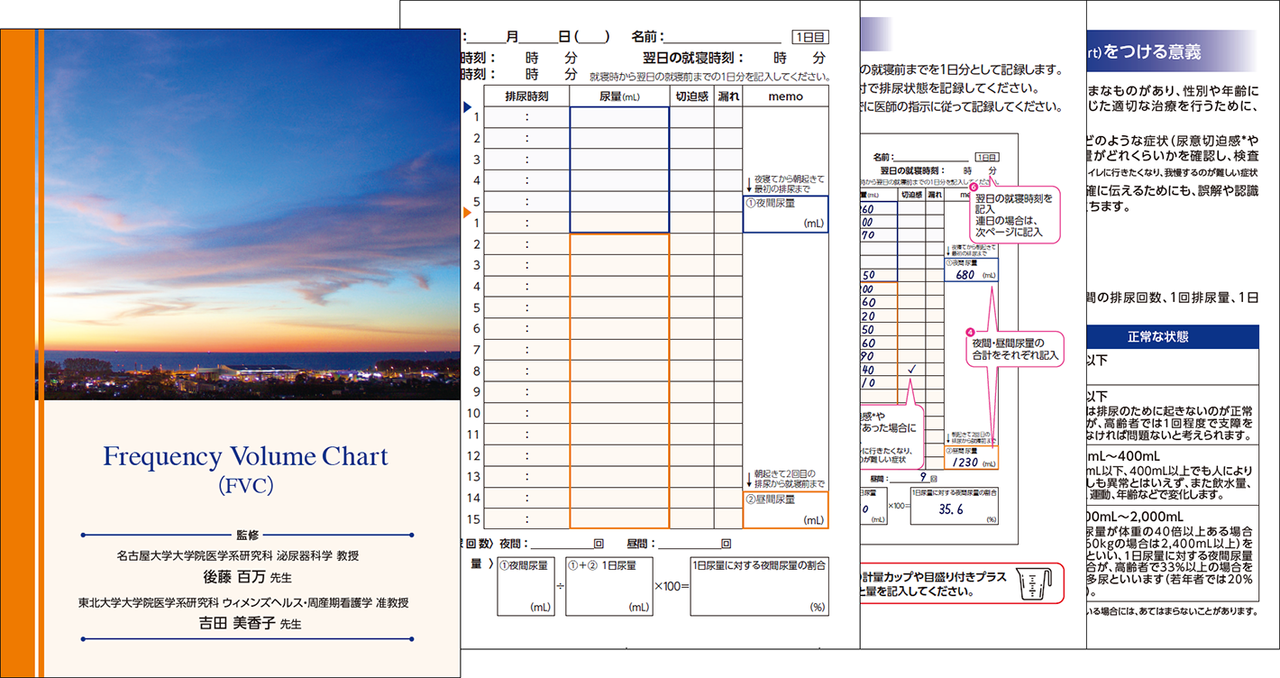 Frequency Volume Chart(FVC)の画像
