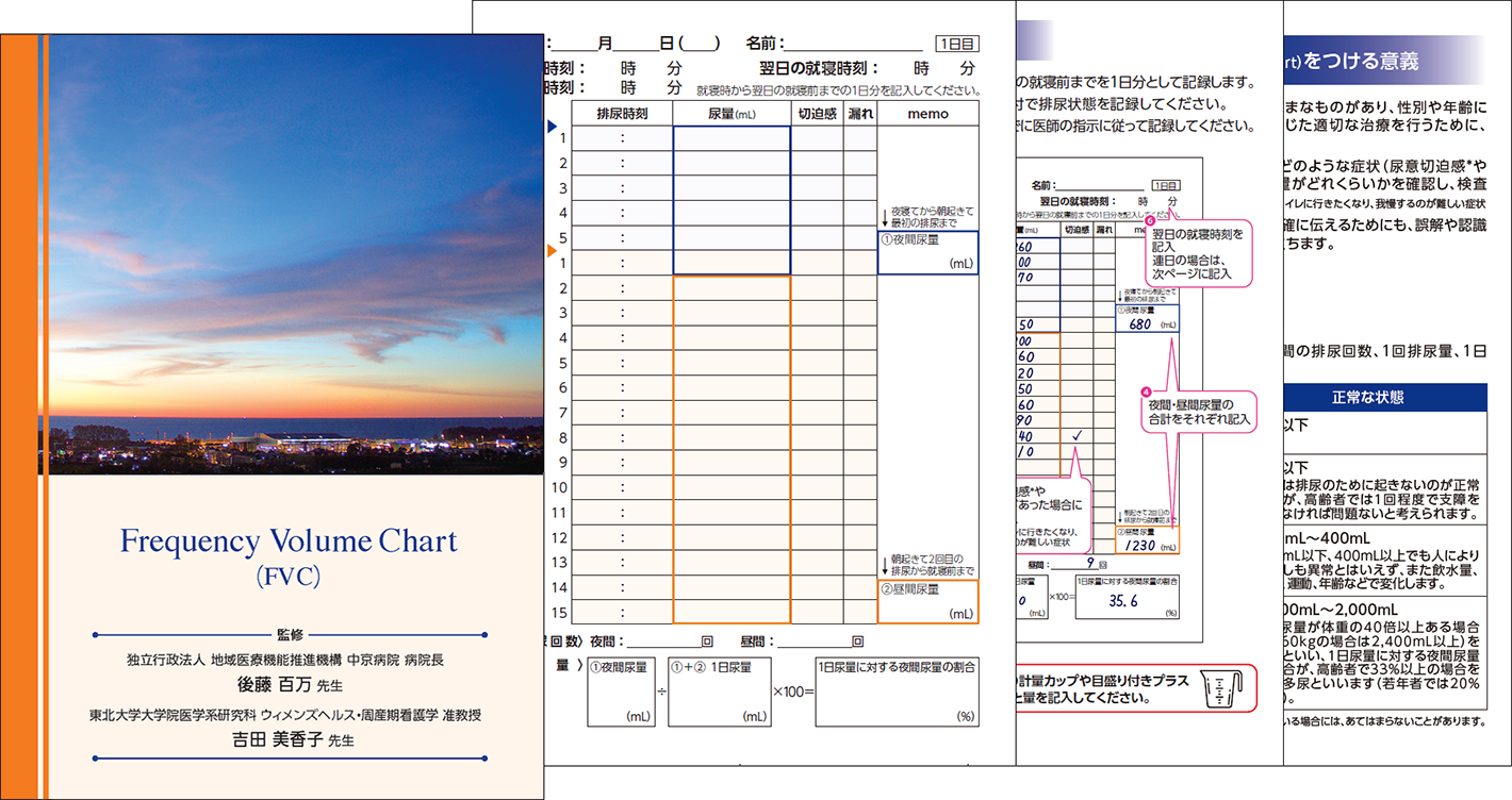 Frequency Volume Chart(FVC)の画像