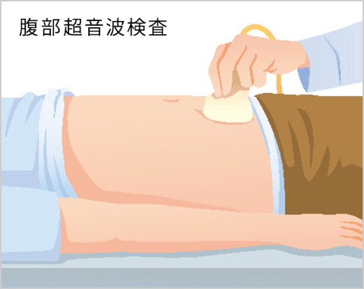 受診したら、どのような検査をするのでしょうか?泌尿器科の検査はよく分からないので、なんとなく不安です。の画像